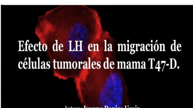 imagen  Seminario de Investigación: Efecto de LH sobre la migración de células tumorales de mama T47-D